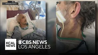 53-year-old hospitalized after brutal beating outside West Hollywood nightclub