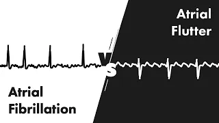 Atrial Fibrillation vs Atrial Flutter - ECG (EKG) Interpretation - MEDZCOOL