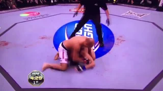 BJ PEN VS DIEGO SANCHEZ TKO DOCTOR STOPPAGE UFC