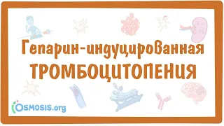 Гепарин индуцированная тромбоцитопения (ГИТ) — причины, симптомы, патогенез, диагностика, лечение