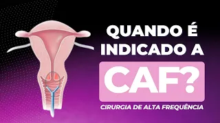 Quando é indicado a CAF?