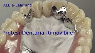 ALE e-Learning - 02 - Protesi Dentaria Rimovibile o Mobile