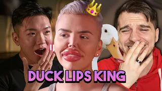 Blind Date With The Plastic King 22+ Surgeries 👁️👄👁️