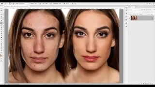 Ретушь методом частотного разложения в Adobe Photoshop