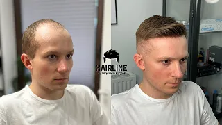 HAIRLINE Niesamowita metamorfoza w 2 godziny! Montaż systemu włosów.