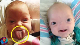 10 Unusual Kids Born with Unbelievable Medical Conditions