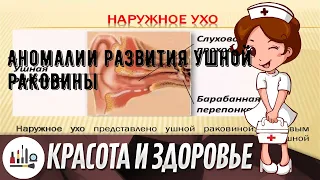 Аномалии развития ушной раковины