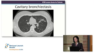 Overview of Nontuberculous Mycobacteria (NTM) and Bronchiectasis