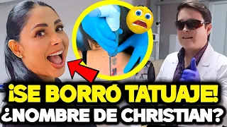 Pamela Franco se borra tatuaje de Christian Domínguez