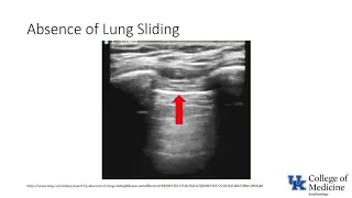 Keyword Review: Respiratory: Lung Ultrasound - (Dr. Bowe)