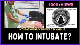 HOW TO INTUBATE? INTUBATION PROCEDURE & TECHNIQUE