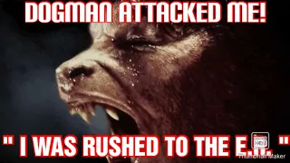 " I WAS ATTACKED BY DOGMAN AND RUSHED TO THE E.R.