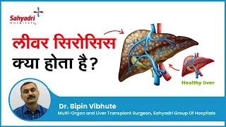 लीवर सिरोसिस क्या होता है? | Liver Cirrhosis In Hindi | Dr. Bipin Vibhute, Sahyadri Hospitals, Pune