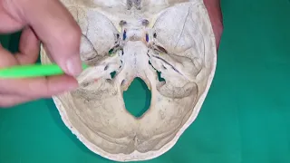 Interior of the Skull 4 - Attachments and Relations (Neuroanatomy)