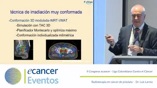 Radioterapia en cáncer de próstata