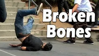 skateboarding fails balls bleeding!🤢(savage skateboarding videos 2019)skateboarding moments#29