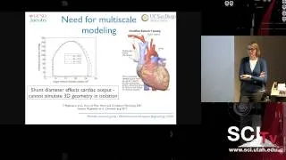 Simulation-based treatment planning in pediatric cardiology