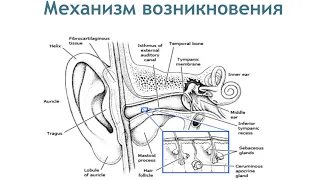 Doc2Doc. Олег Абрамов - Заболевание наружного уха у детей