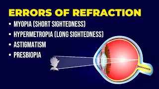 Errors of Refraction | Myopia | Hypermetropia | Astigmatism | Presbiopia | Short & Long Sightedness