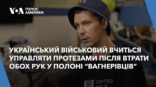 Український військовий вчиться управляти протезами після втрати обох рук у полоні “вагнeрівців”