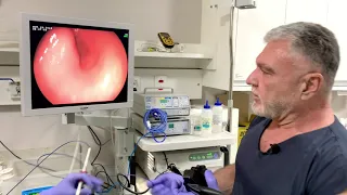 Endoscopia - Queixa de Dor Abdominal, Azia e Vômito