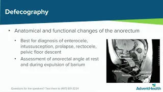 Multidisciplinary Approach to Lower GI Motility and Anorectal Disorders