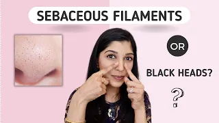 Black Dots On The Nose? How To Treat Sebaceous Filaments | Dr. Swati Kannan