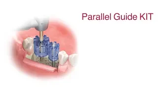 Parallel Guide KIT RUS