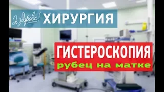 Гистероскопия  Рубец на матке