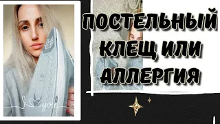 Постельный клещ или аллергия? Моё решение...