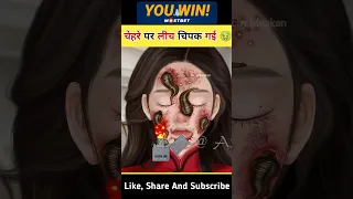 चेहरे पर leech चिपक गई 🤢 #asmr #trendingshorts