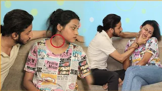 Love Bite Prank On Boyfriend ll Prank On My Boyfriend ll Ishu Solankiii