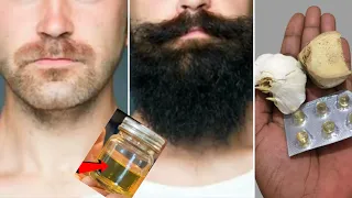 Comment faire pousser une barbe en 1 semaine. Traitement naturel de la barbe et des poils du visage