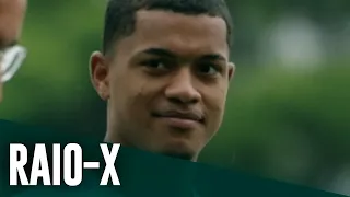 RAIO-X DAS CRIAS: PEDRO FELIPE