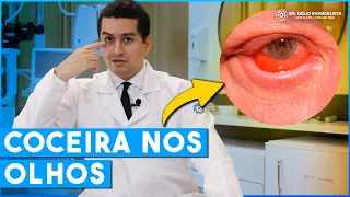 Olhos COÇANDO MUITO, O que pode ser?