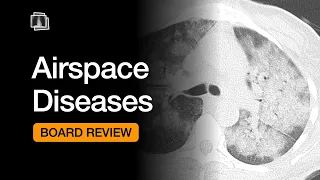 Airspace Diseases | Chest Radiology Board Review