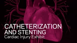 Cardiac Catheterization and Stenting