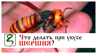 🔥ЧТО ДЕЛАТЬ ПРИ УКУСЕ ШЕРШНЯ?🔥