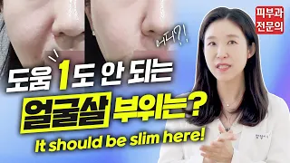 (*Eng) 얼굴 이 부위에 살 많은 분들 제발 보세요!😭 It should be slim here! - 피부과전문의 [닥터필러]