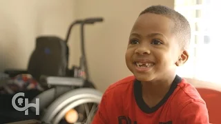 First Bilateral Hand Transplant in a Child: Zion's Story