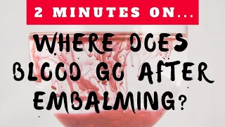 Where Does Blood Go After Embalming? - Just Give Me 2 Minutes