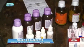 Criança é picada na cabeça por carrapato e contrai grave infecção