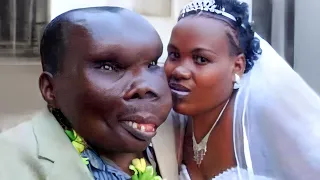 Everyone Laughed When She Married an Ugly Disfigured Man. Years Later, They Regretted it!