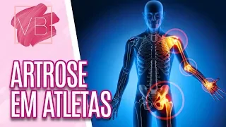 Artrose em atletas: prevenção e tratamento - Você Bonita (08/07/19)