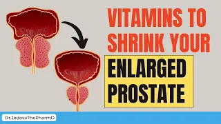 Best Vitamins to Shrink Your Enlarged Prostate