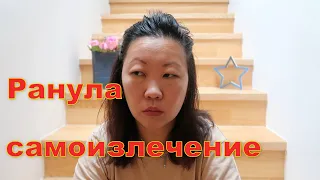 Ранула-нереальное исцеление?