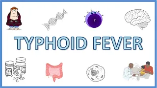 Typhoid Fever - Causes, Pathogenesis, Signs and Symptoms, Diagnosis, Treatment and Prevention