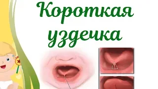 Короткая уздечка под языком у ребенка! Как определить и помочь?