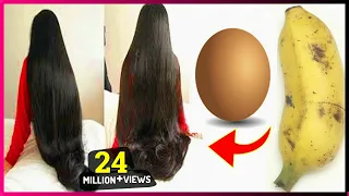 How To Grow Shine and Silky Hair Faster With Egg & Banana !! Super Fast Hair Growth Challenge!