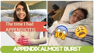 FUNNY THE TIME I FOUND OUT I HAD APPENDICITIS | STORY TIME (story, surgery, recovery)